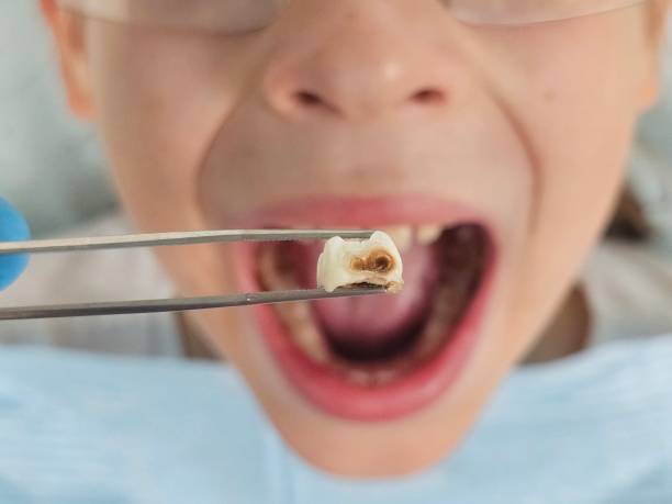 Best Urgent Care for Lost Fillings or Crowns in Pardeeville, WI